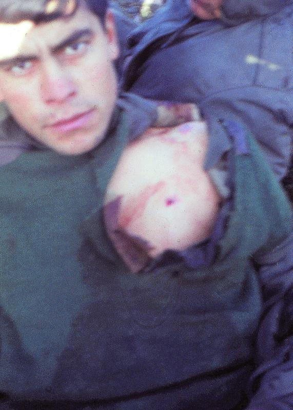Argentine casualty with minor chest wound.